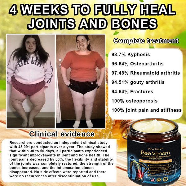 Official Store: Vioralifes™ Bee Venom and Turmeric Joint and Bone Pain Relief Cream 👨⚕️ Approved by the American Academy of Orthopaedic Surgeons (AAOS)