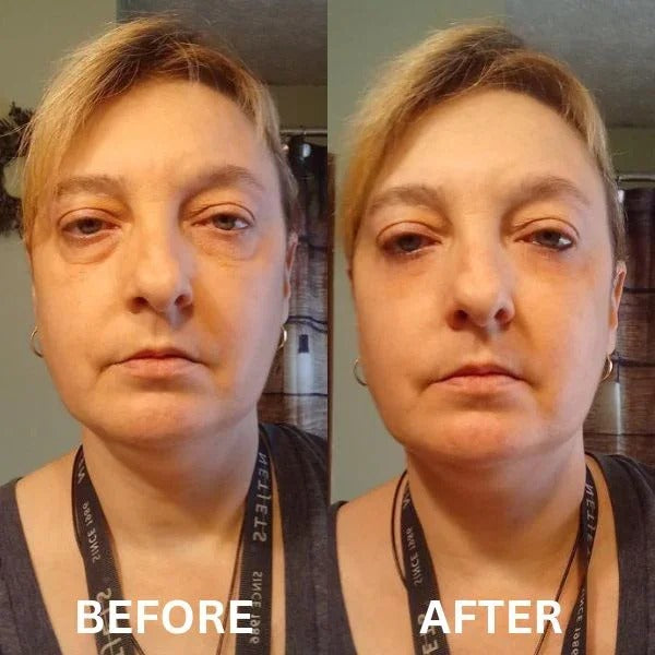 InstantFirm Eye Patches | 1+1 FREE