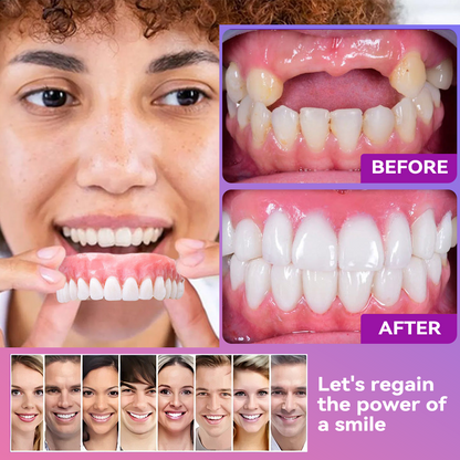 Vioralifes® Next-Generation Comfort Dentures (Luxurious dentures, lightweight and easy to wear — limited-time 70% OFF)